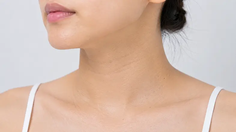PicoSure Pro蜂巢皮秒激光颈部疗程前参考图