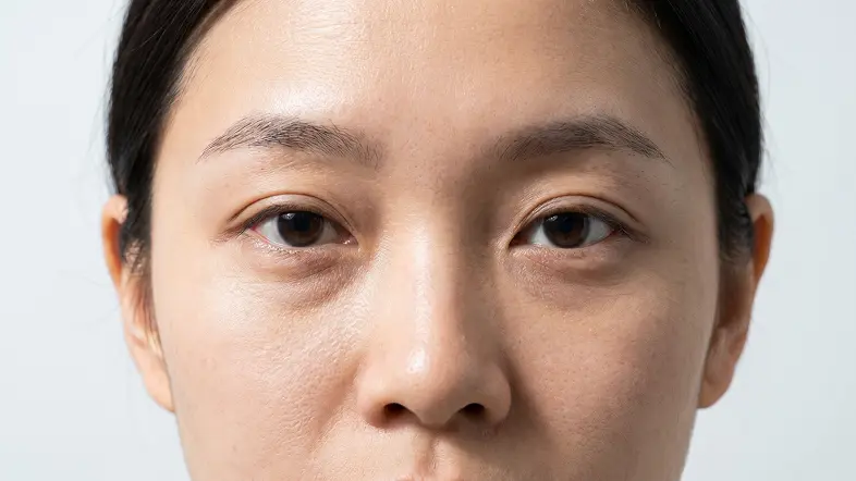 RRS西班牙眼妆针前参考图